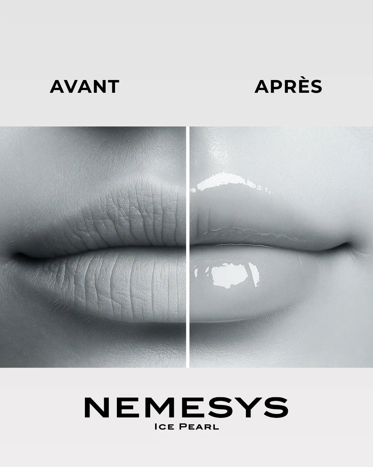Comparatif lèvres avant et après application du gloss NEMESYS Ice Pearl, ridules lissées et brillance miroir.