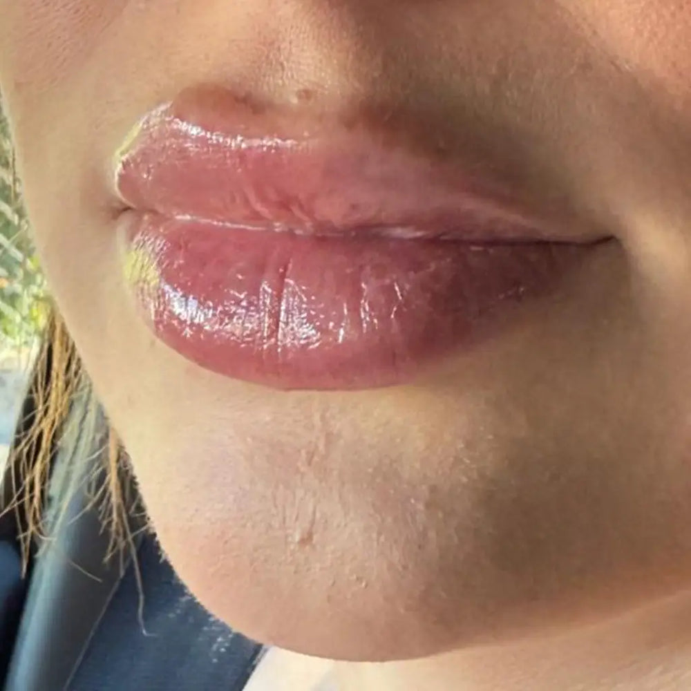 Résultat lèvres repulpées gloss repulpant Volcano Kiss — volume visible, brillance effet 3D