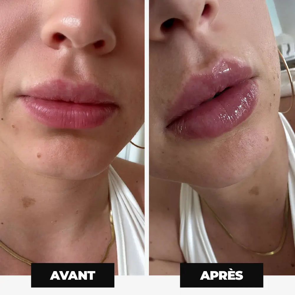 Avant après gloss repulpant Volcano Kiss — lèvres plus pulpeuses, volume immédiat, effet thermo-actif