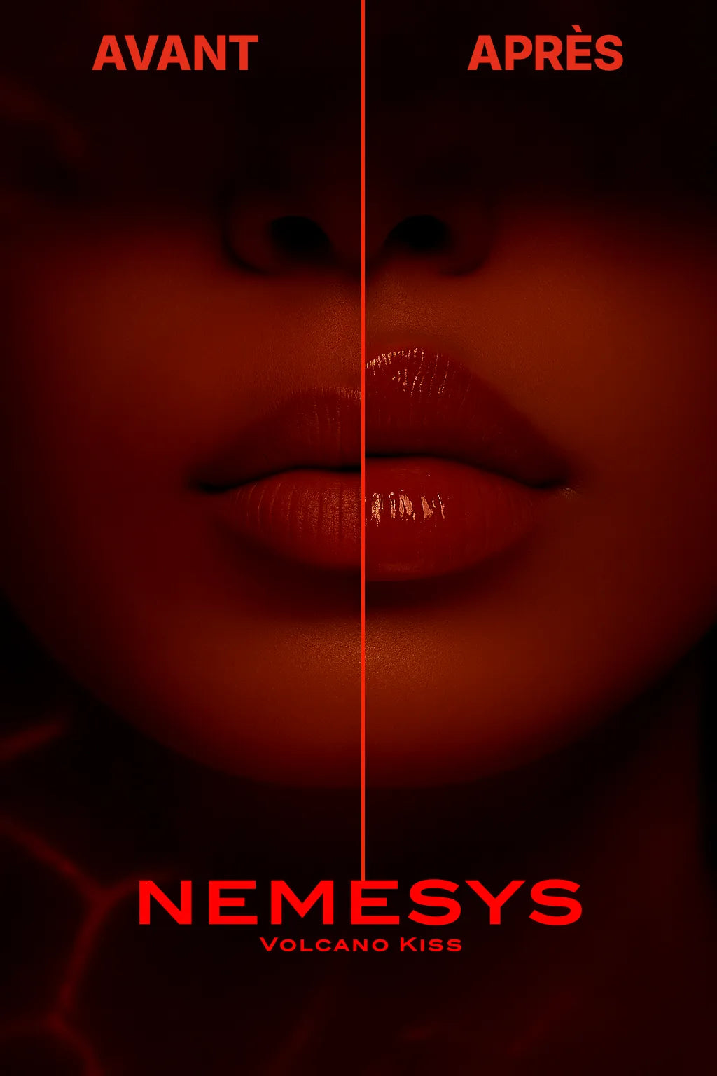 Image divisée en deux moitiés verticales. À gauche : lèvres mates avec mention “AVANT”. À droite : lèvres glossées pulpeuses avec effet miroir et mention “APRÈS”. En bas, logo NEMESYS™ Volcano Kiss.